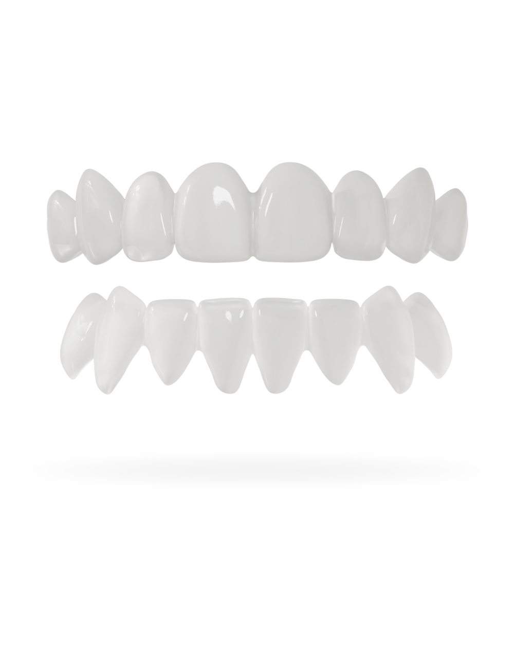 Teeth-Veneer 2.0