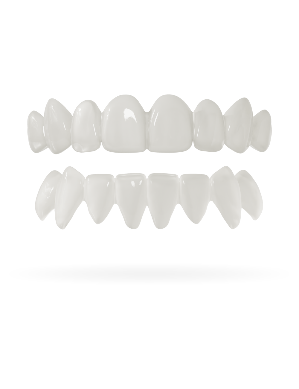 Teeth-Veneer 2.0