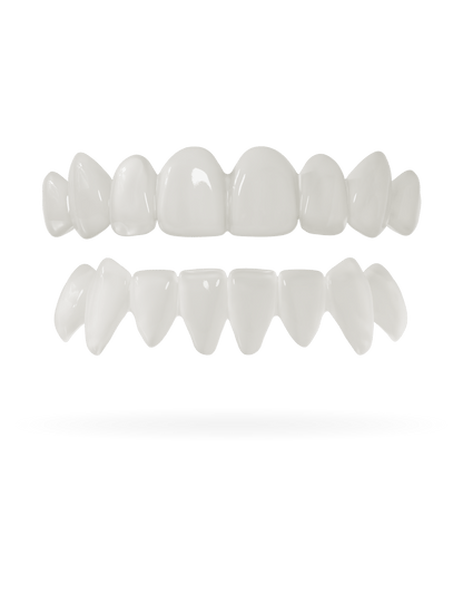 Teeth-Veneer 2.0