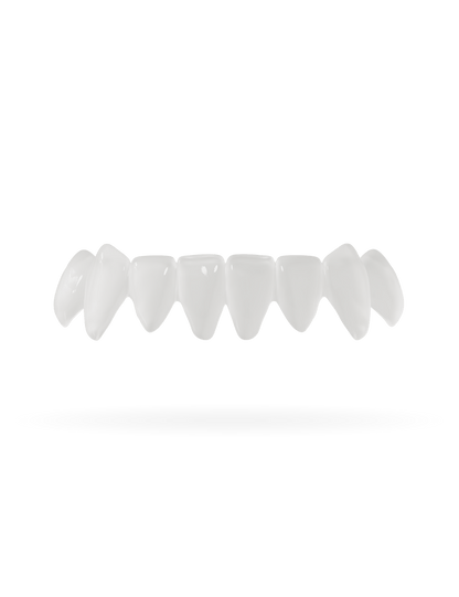 Teeth-Veneer 2.0
