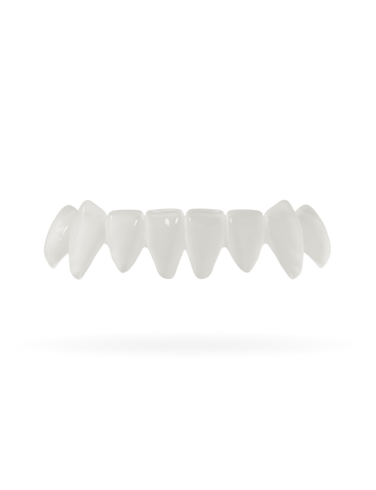 Teeth-Veneer 2.0