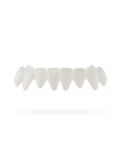 Teeth-Veneer 3.0